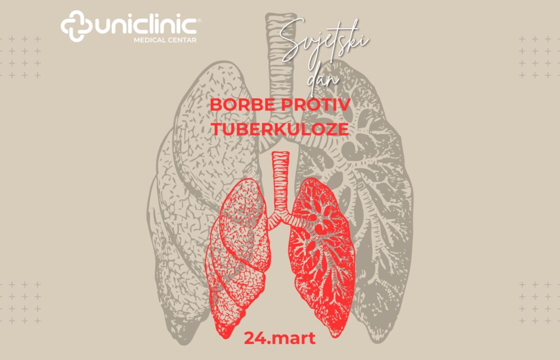 24 mart svjetski dan borbe protiv tuberkuloze - poster