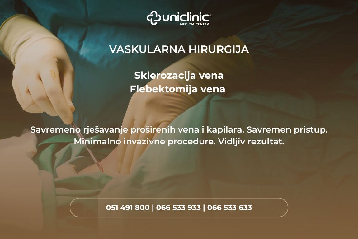 poster skelrozacija i flebektomija