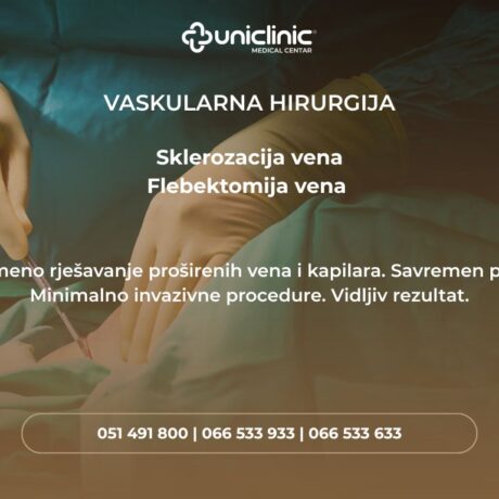 poster skelrozacija i flebektomija