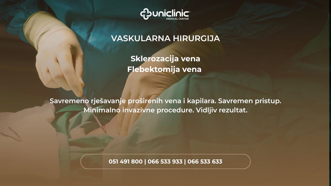poster skelrozacija i flebektomija