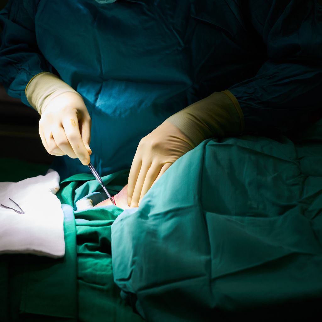 vaskularna operacija u uniclinic