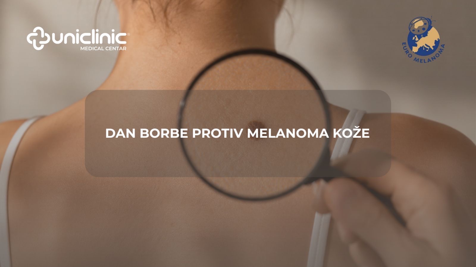 15 maj dan borbe protiv melanoma kože